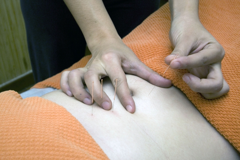 osteopathe-TRANS EN PROVENCE-min_acupuncture-4175625